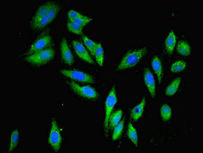 PARP3 Antibody in Immunocytochemistry (ICC/IF)