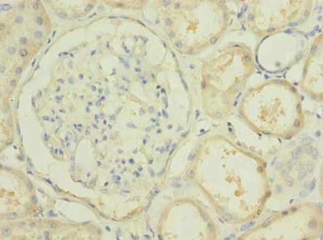 PBLD Antibody in Immunohistochemistry (Paraffin) (IHC (P))