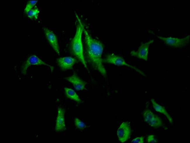 PEAR1 Antibody in Immunocytochemistry (ICC/IF)