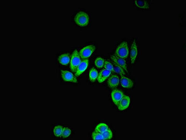 PFDN2 Antibody in Immunocytochemistry (ICC/IF)