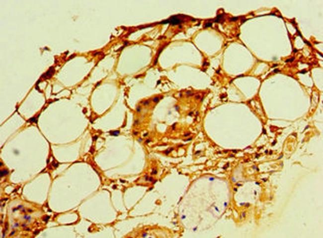 POP7 Antibody in Immunohistochemistry (Paraffin) (IHC (P))