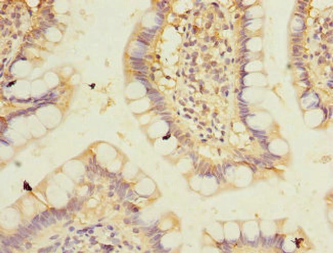 PPM1D Antibody in Immunohistochemistry (Paraffin) (IHC (P))