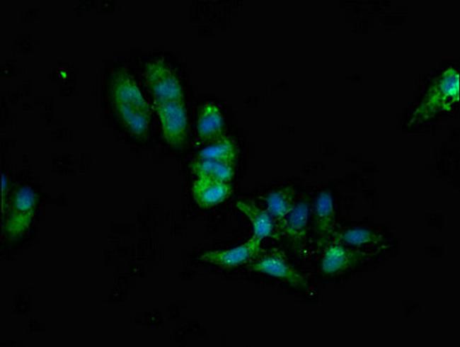 PPP2R2A Antibody in Immunocytochemistry (ICC/IF)