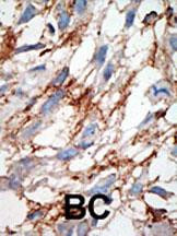 ISG15 Antibody in Immunohistochemistry (Paraffin) (IHC (P))