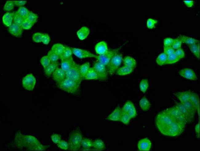 RFXANK Antibody in Immunocytochemistry (ICC/IF)