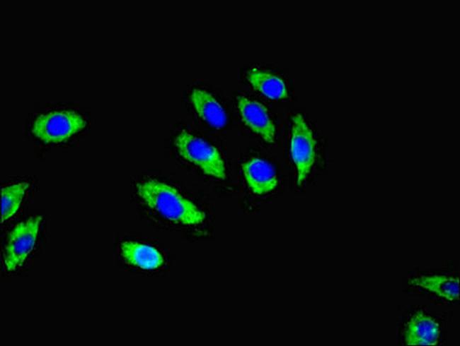 RGS20 Antibody in Immunocytochemistry (ICC/IF)