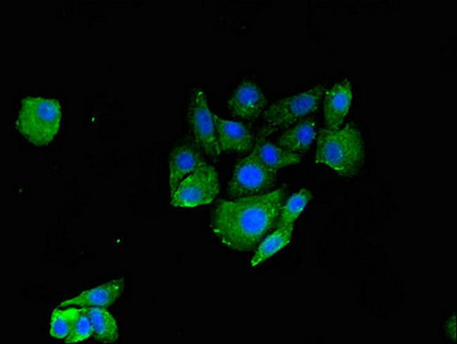 RNF126 Antibody in Immunocytochemistry (ICC/IF)