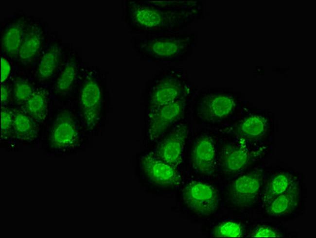 RPL23A Antibody in Immunocytochemistry (ICC/IF)