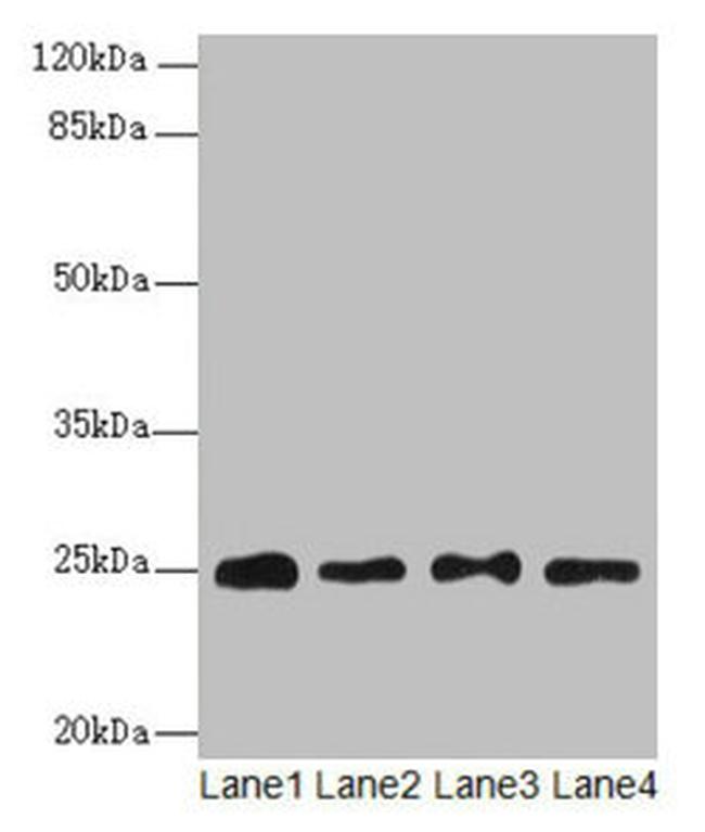 RPS8 Antibody in Western Blot (WB)