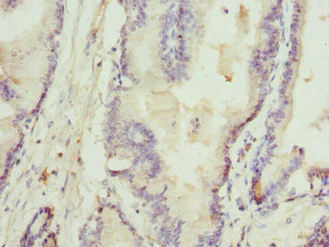 Rhotekin Antibody in Immunohistochemistry (Paraffin) (IHC (P))