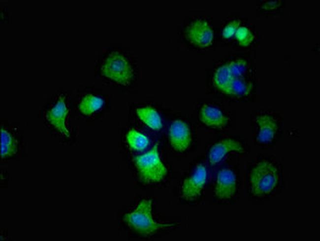 SLC22A2 Antibody in Immunocytochemistry (ICC/IF)