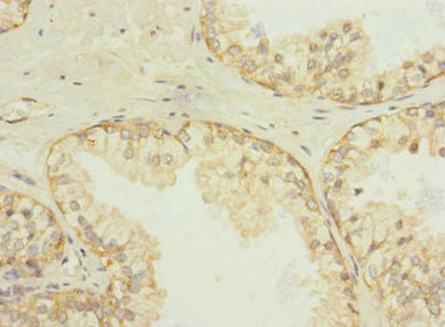 SQRDL Antibody in Immunohistochemistry (Paraffin) (IHC (P))