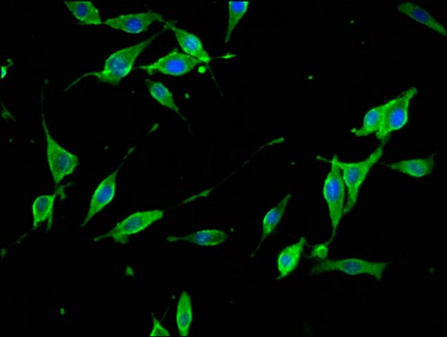 Synaptojanin 1 Antibody in Immunocytochemistry (ICC/IF)