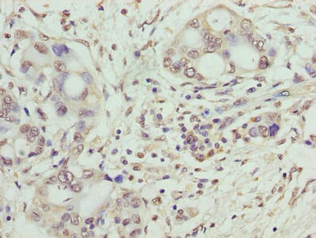 SYNJ2BP Antibody in Immunohistochemistry (Paraffin) (IHC (P))