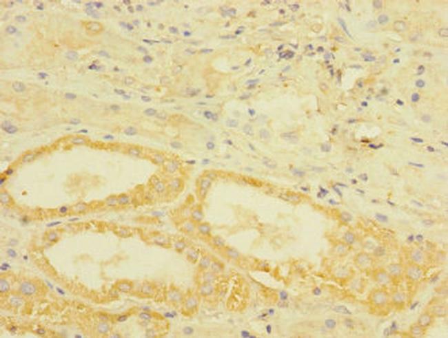 TGFBR3 Antibody in Immunohistochemistry (Paraffin) (IHC (P))