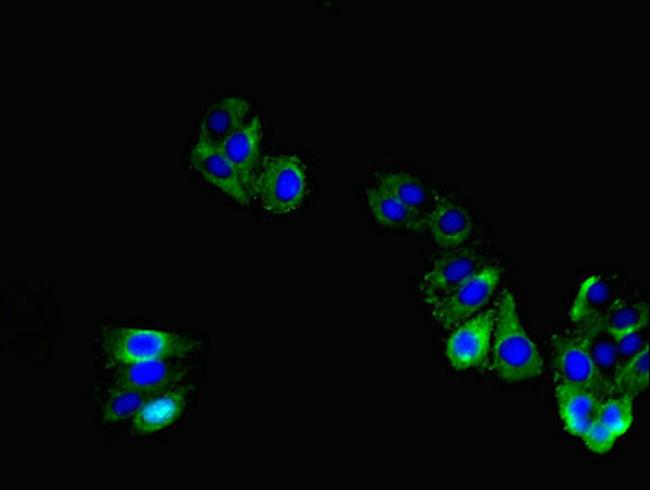 TNMD Antibody in Immunocytochemistry (ICC/IF)