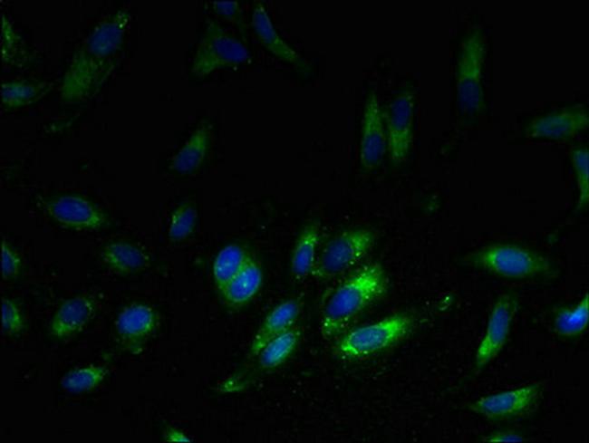 RPL38 Antibody in Immunocytochemistry (ICC/IF)