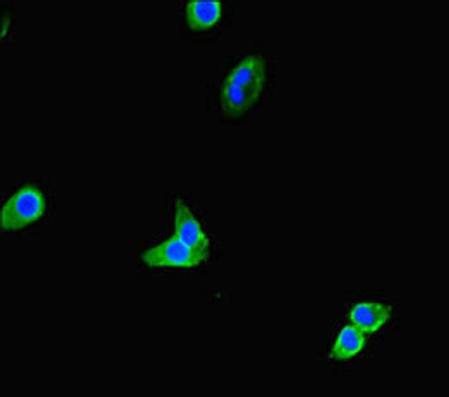 TOX3 Antibody in Immunocytochemistry (ICC/IF)