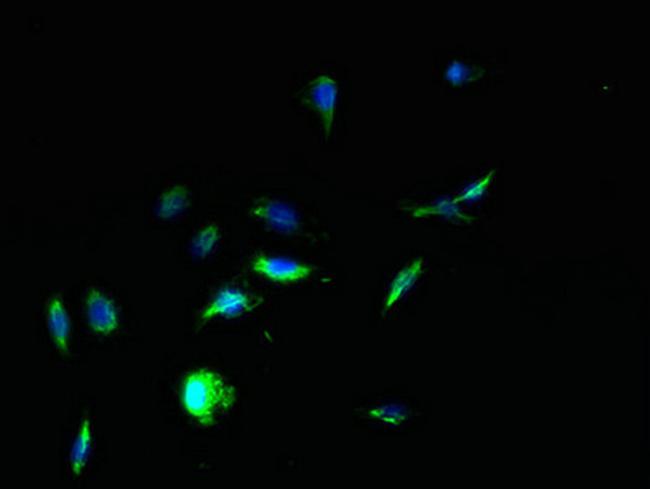 PTEN2 Antibody in Immunocytochemistry (ICC/IF)