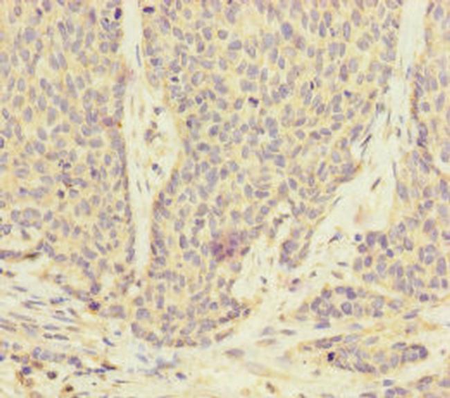 UACA Antibody in Immunohistochemistry (Paraffin) (IHC (P))