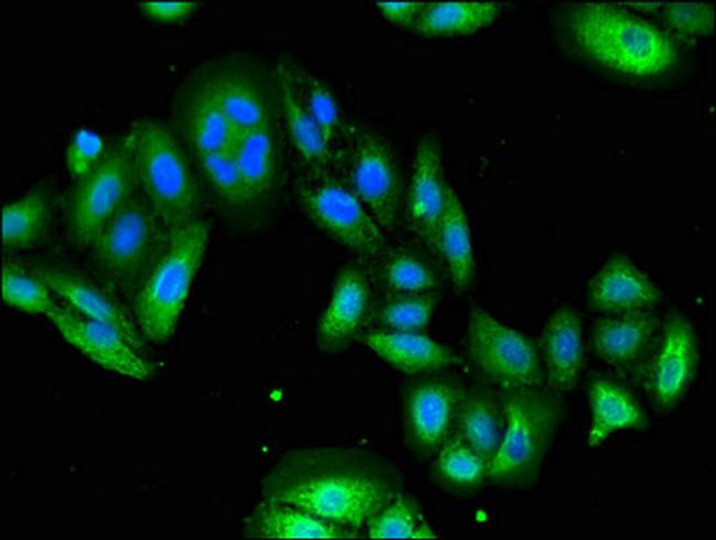 USP6 Antibody in Immunocytochemistry (ICC/IF)