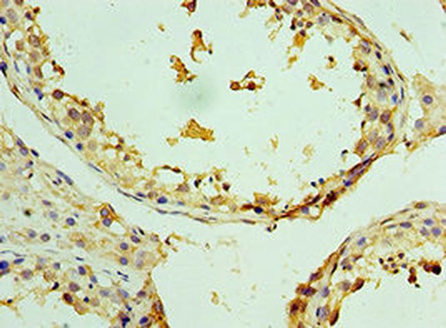 ZMYND10 Antibody in Immunohistochemistry (Paraffin) (IHC (P))