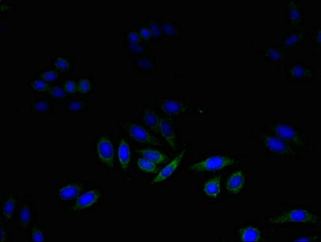 DAD1 Antibody in Immunocytochemistry (ICC/IF)