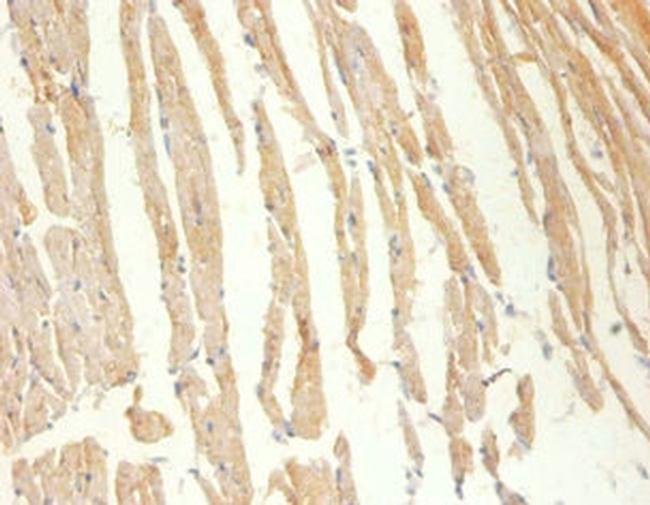 Creatine Kinase MM Antibody in Immunohistochemistry (Paraffin) (IHC (P))