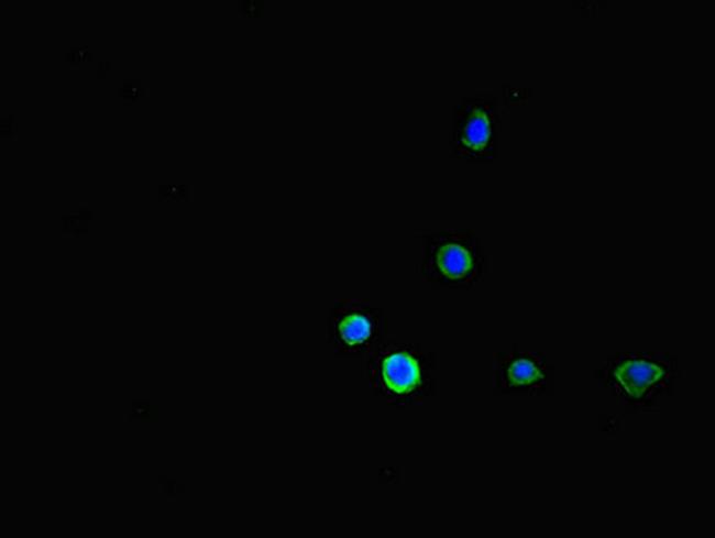 FCGR2B Antibody in Immunocytochemistry (ICC/IF)