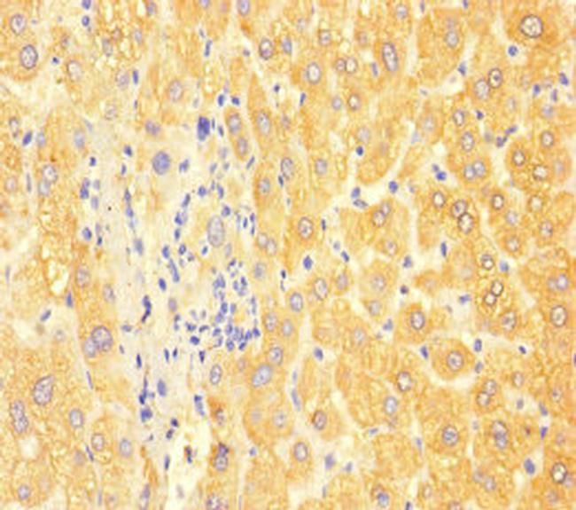 ApoC3 Antibody in Immunohistochemistry (Paraffin) (IHC (P))