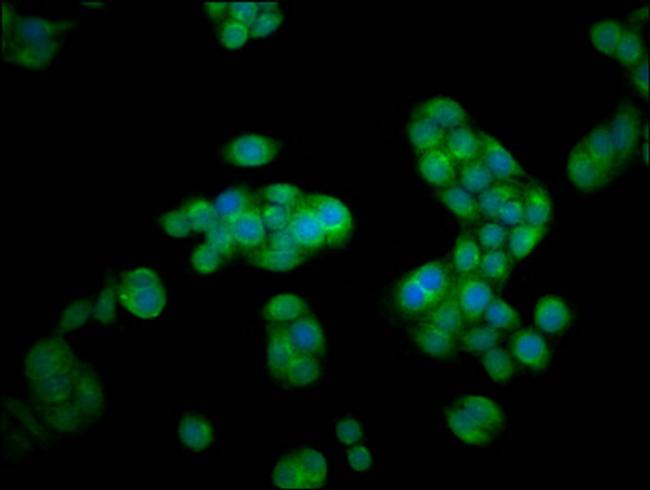 HEXA Antibody in Immunocytochemistry (ICC/IF)