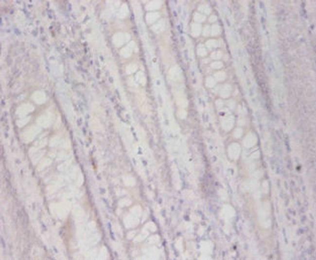 FUCA2 Antibody in Immunohistochemistry (Paraffin) (IHC (P))