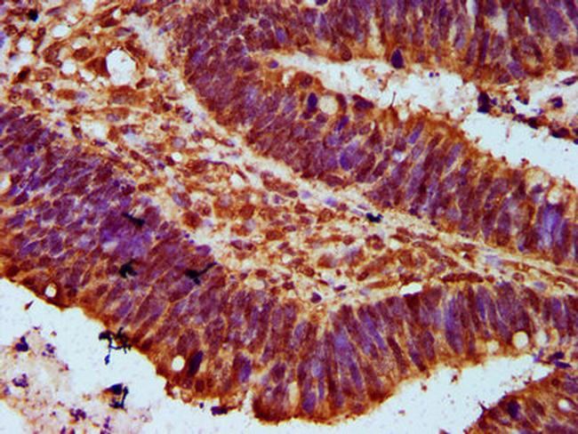 MTMR15 Antibody in Immunohistochemistry (Paraffin) (IHC (P))