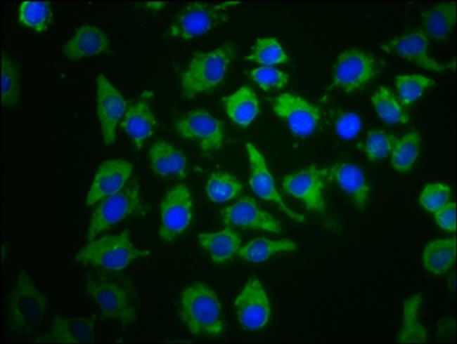 PDE6C Antibody in Immunocytochemistry (ICC/IF)