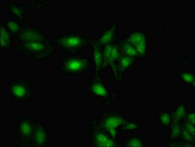 RBMY1A1 Antibody in Immunocytochemistry (ICC/IF)