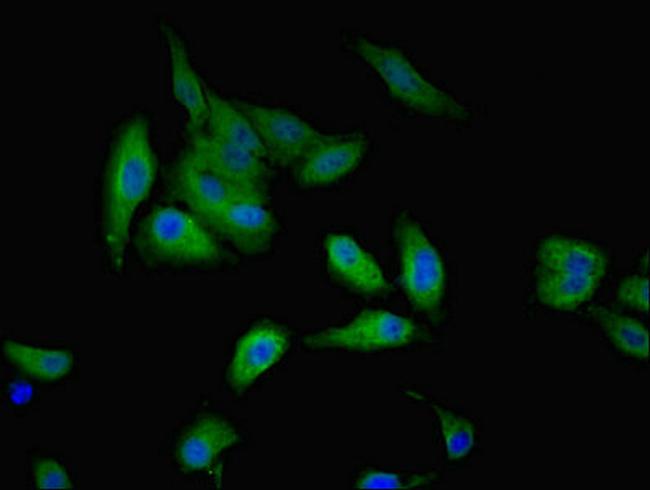 GALE Antibody in Immunocytochemistry (ICC/IF)