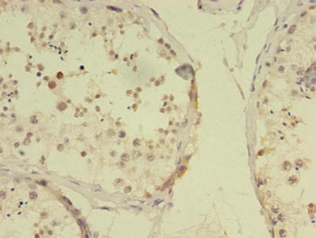 RBMY1F Antibody in Immunohistochemistry (Paraffin) (IHC (P))