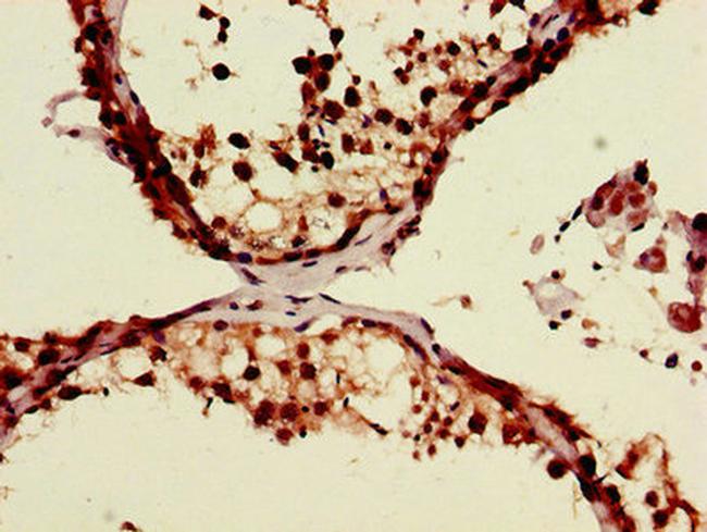 ZRSR2 Antibody in Immunohistochemistry (Paraffin) (IHC (P))