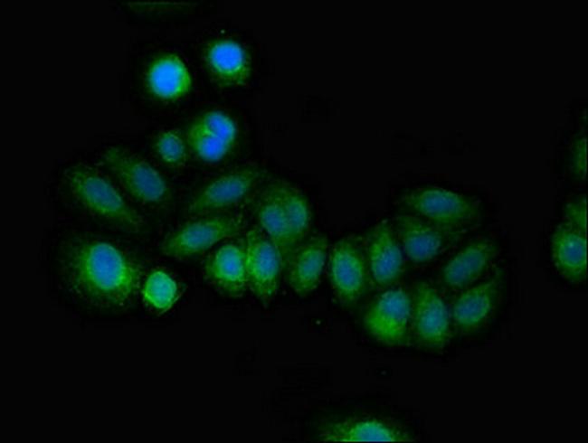 RCAN2 Antibody in Immunocytochemistry (ICC/IF)