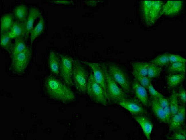 RALBP1 Antibody in Immunocytochemistry (ICC/IF)