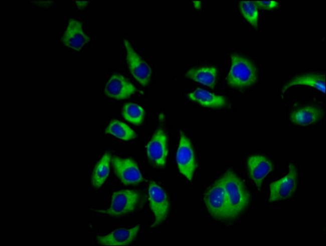 CNGB1 Antibody in Immunocytochemistry (ICC/IF)