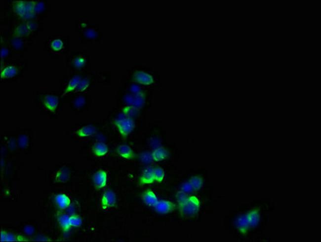 EBP Antibody in Immunocytochemistry (ICC/IF)