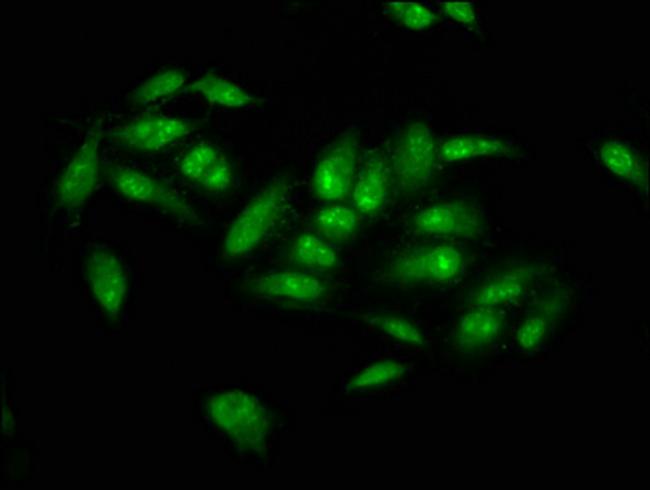 NSUN2 Antibody in Immunocytochemistry (ICC/IF)