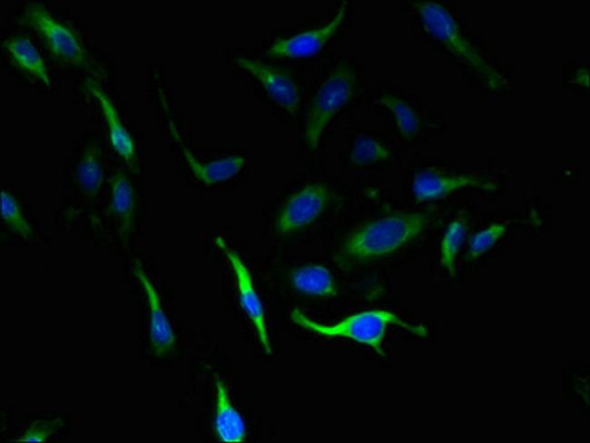 SLC4A8 Antibody in Immunocytochemistry (ICC/IF)