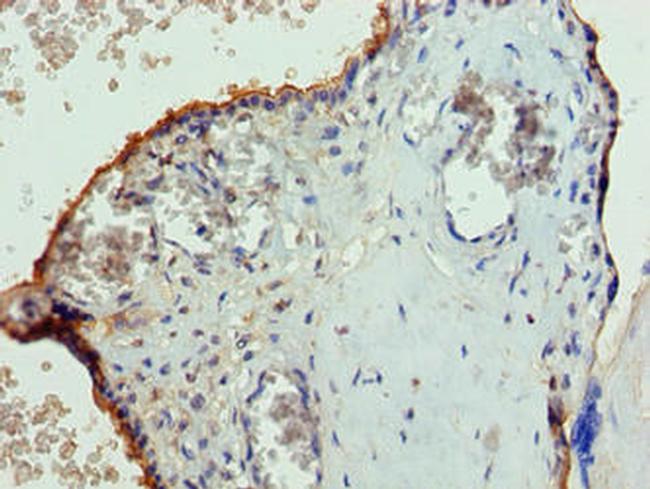 PGS1 Antibody in Immunohistochemistry (Paraffin) (IHC (P))