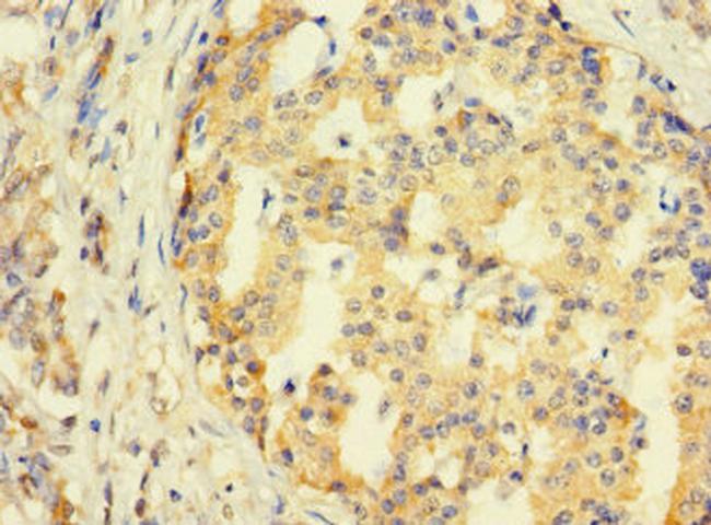 SYTL3 Antibody in Immunohistochemistry (Paraffin) (IHC (P))