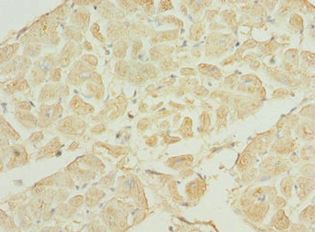 TNNI3K Antibody in Immunohistochemistry (Paraffin) (IHC (P))