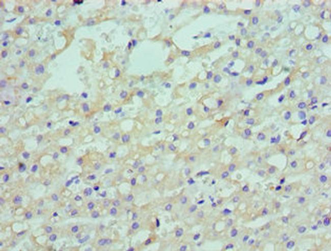 LDLRAP1 Antibody in Immunohistochemistry (Paraffin) (IHC (P))