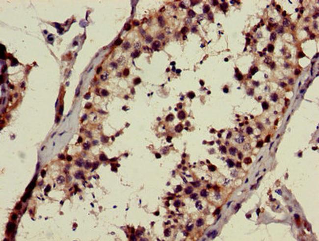 CHST9 Antibody in Immunohistochemistry (Paraffin) (IHC (P))