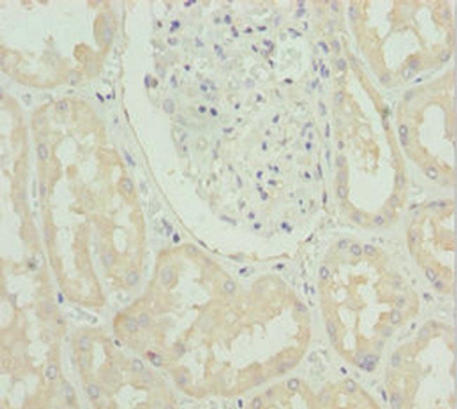 SLC39A4 Antibody in Immunohistochemistry (Paraffin) (IHC (P))